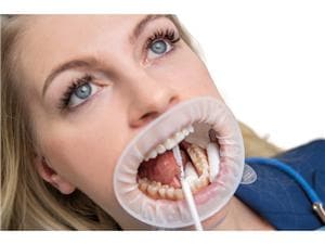 OptraGate® - Sortiment Regular 40 Stück und Small 40 Stück
