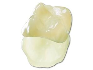 3M Lava™ Ultimate - Trial Kit for CEREC® Set