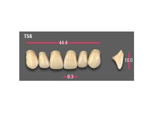 VITAPAN® Anterior VITA classical A1-D4® Vitapan Fz A1 L10