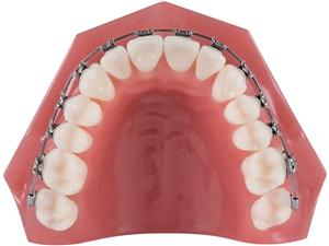 TRIFECTA® THERMOELASTISCHE NICKEL-TITAN DRAHTBÖGEN, rechteckig, geätzt OK, .016" x .016", Kraftniveau in Gramm: Frontzahn 6