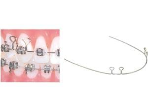 TruForce™ Edelstahl-Retraktionsbögen mit 4 Omegaschlaufen, rechteckig OK / UK, .016" x .022", Bogen 24 mm