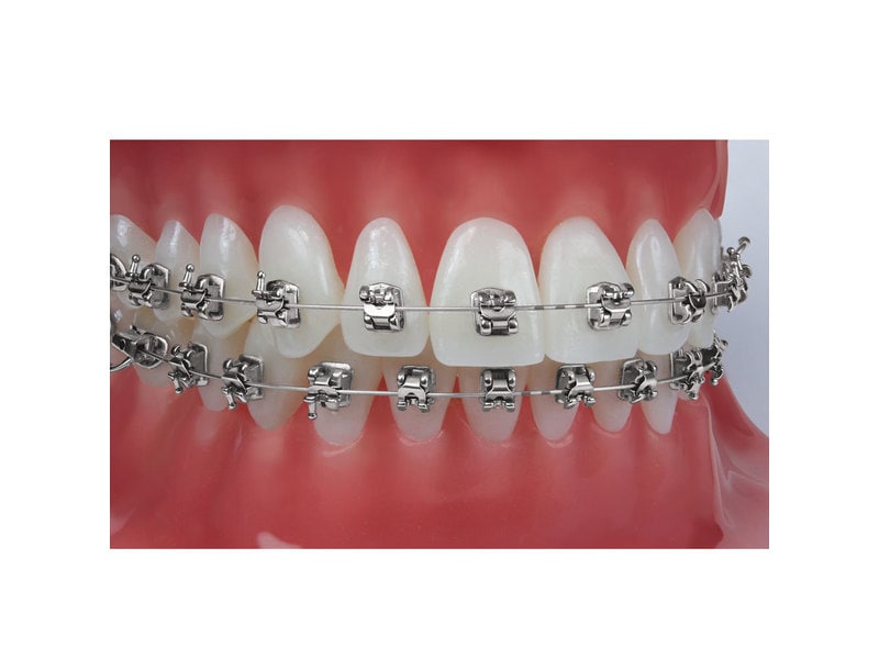 Sensation M Roth Prescription .022" Slot, Einzelpackung Zahn 23, 2