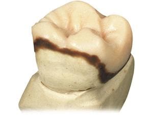 Ästhetic Inlay Wachs Beige - transparent, Dose 70 g