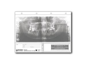Panostar® Typ 4 - Startersystem Set