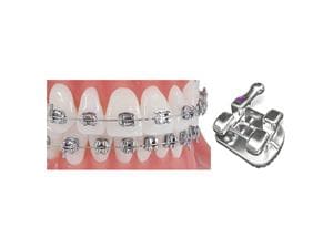 Pinnacle MBT Prescription .022" Slot, mit Torque -7° bzw. -6° auf 3ern, Einzelpackung Zahn 11 +17° Torque, ohne Häkchen, oh