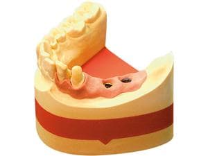 Implantat-rock® Gold, Karton 20 kg
