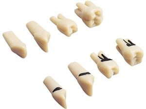 Modellzahn mit Schrauben A-PB ZE3 Zahn 16