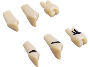 Modellzähne mit Schrauben A-PZ Z - Sortiment Sortiment