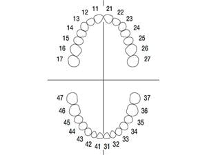 Modellzähne mit Schrauben ANA-4 - Sortiment Sortiment