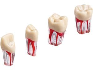 Modellzähne mit Klicksystem ANKA-4 ZPUK Zahn 21