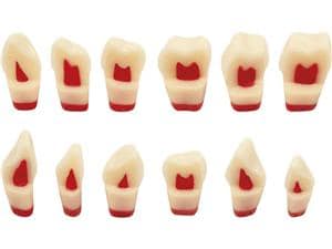 Dreischicht-Zahn ANA-4 ZSDP Zahn 21