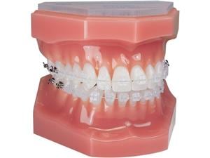 Ortho Technology Typodonten zur Demonstration Typodont PURE Saphir