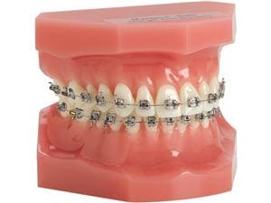 Ortho Technology Typodonten zur Demonstration Typodont Marquis Edelstahl