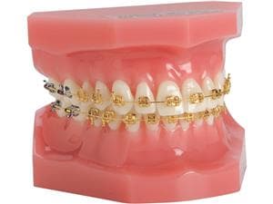 Ortho Technology Typodonten zur Demonstration Typodont Marquis TruGold