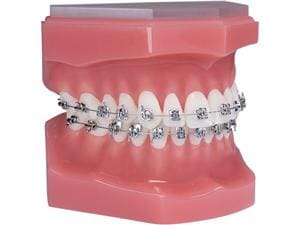 Ortho Technology Typodonten zur Demonstration Typodont Lotus Plus Passiv Selbstligierend Idealverzahnung