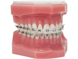 Ortho Technology Typodonten zur Demonstration Typodont Votion Edelstahl