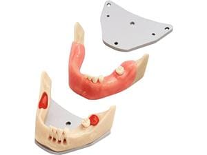 Chirurgie-Trainingsmodell A-J OP UK