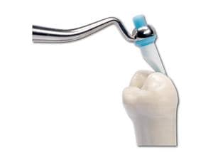 OptraSculpt® Next Generation - Refill Chisel, Packung 60 Stück