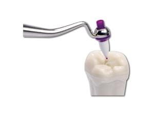 OptraSculpt® Next Generation - Refill Spitze, Packung 60 Stück
