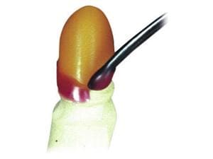 Pro-Mod C Cervikalwachs Rot, Dose 70 g