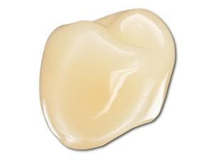 3M Protemp™ Crown - Einzelkrone Eckzahn (universal) L, Packung 5 Stück