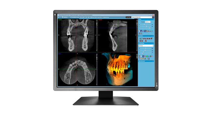 EIZO RadiForce MX216-SB