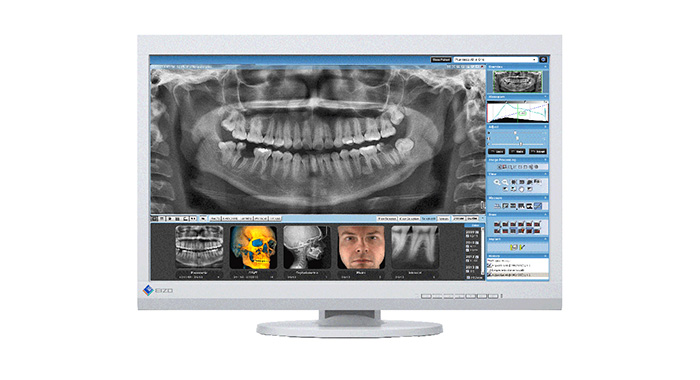 EIZO RadiForce MSW-DT